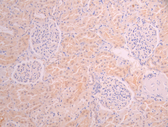 IHC image of CSB-RA018403MA1HU diluted at 1:50 and staining in paraffin-embedded human kidney tissue performed on a Leica BondTM system. After dewaxing and hydration, antigen retrieval was mediated by high pressure in a citrate buffer (pH 6.0). Section was blocked with 10% normal goat serum 30min at RT. Then primary antibody (1% BSA) was incubated at 4°C overnight. The primary is detected by a Anti-Human lgG, Fcy Fragment Specific labeled by HRP and visualized using 0.05% DAB.
