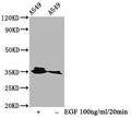 Phospho-PPP2CA (Y307) Antibody – Figure 1 of 1