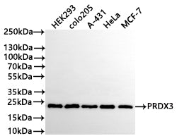 Western Blot
Positive WB detected in: HEK293 whole cell lysate(30µg), colo205 whole cell lysate(30µg), A-431 whole cell lysate(30µg), Hela whole cell lysate(30µg), MCF-7 whole cell lysate(30µg)
All lanes: PRDX3 antibody at 1:1000
Secondary
Goat polyclonal to human IgG at 1/40000 dilution
Predicted band size: 28 kDa
Observed band size: 25 kDa
Exposure time: 20s