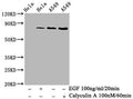 Western Blot
Positive WB detected in Hela whole cell lysate, A549 whole cell lysate(treated with Calyculin A or EGF) 
All lanes Phospho-PRKCA antibody at 0.68μg/ml
Secondary
Goat polyclonal to rabbit IgG at 1/50000 dilution
Predicted band size: 80 KDa
Observed band size: 80 KDa