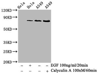Western Blot
Positive WB detected in Hela whole cell lysate, A549 whole cell lysate(treated with Calyculin A or EGF) 
All lanes Phospho-PRKCA antibody at 0.68μg/ml
Secondary
Goat polyclonal to rabbit IgG at 1/50000 dilution
Predicted band size: 80 KDa
Observed band size: 80 KDa