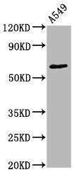 Phospho-PRKCZ (T560) Antibody – Figure 1 of 1