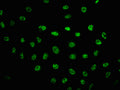 Immunofluorescence staining of Hela cells(treated with UV) with CSB-RA018714A2056phHU at 1:100,counter-stained with DAPI. The cells were fixed in 4% formaldehyde, permeabilized using 0.2% Triton X-100 and blocked in 10% normal Goat Serum. The cells were then incubated with the antibody overnight at 4℃. The secondary antibody was Alexa Fluor 488-congugated AffiniPure Goat Anti-Rabbit IgG (H+L) .