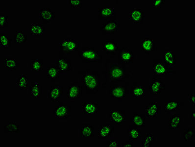 Immunofluorescence staining of Hela cells(treated with UV) with CSB-RA018714A2056phHU at 1:100,counter-stained with DAPI. The cells were fixed in 4% formaldehyde, permeabilized using 0.2% Triton X-100 and blocked in 10% normal Goat Serum. The cells were then incubated with the antibody overnight at 4℃. The secondary antibody was Alexa Fluor 488-congugated AffiniPure Goat Anti-Rabbit IgG (H+L) .