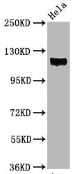 Western Blot
Positive WB detected in Hela whole cell lysate
All lanes Phospho-PTK2 antibody at 3.05μg/ml
Secondary
Goat polyclonal to rabbit IgG at 1/50000 dilution
Predicted band size: 119 KDa
Observed band size: 119 KDa