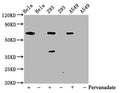 Western Blot
Positive WB detected in Hela whole cell lysate,  293 whole cell lysate, A549 whole cell lysate(treated with Pervanadate or not) 
All lanes Phospho-PTPN11 antibody at 0.65μg/ml
Secondary
Goat polyclonal to rabbit IgG at 1/50000 dilution
Predicted band size: 68 KDa
Observed band size: 68 KDa