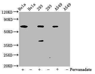 Western Blot
Positive WB detected in Hela whole cell lysate,  293 whole cell lysate, A549 whole cell lysate(treated with Pervanadate or not) 
All lanes Phospho-PTPN11 antibody at 0.65μg/ml
Secondary
Goat polyclonal to rabbit IgG at 1/50000 dilution
Predicted band size: 68 KDa
Observed band size: 68 KDa