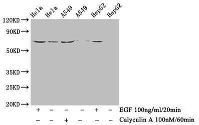 Western Blot
Positive WB detected in Hela whole cell lysate,A549 whole cell lysate,HepG2 whole cell lysate(treated with Calyculin A or EGF) 
All lanes Phospho-PXN antibody at 1.43μg/ml
Secondary
Goat polyclonal to rabbit IgG at 1/50000 dilution
Predicted band size: 68 KDa
Observed band size: 68 KDa