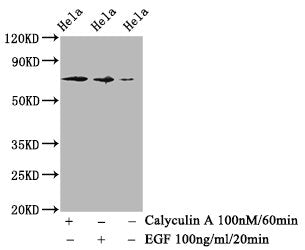 Western Blot
Positive WB detected in Hela whole cell lysate(treated with Calyculin A or EGF) 
All lanes Phospho-RAF1 antibody at 1.18μg/ml
Secondary
Goat polyclonal to rabbit IgG at 1/50000 dilution
Predicted band size: 73 KDa
Observed band size: 73 KDa