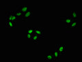Immunofluorescence staining of Hela with CSB-RA019284A43phHU at 1:100,counter-stained with DAPI. The cells were fixed in 4% formaldehyde, permeabilized using 0.2% Triton X-100 and blocked in 10% normal Goat Serum. The cells were then incubated with the antibody overnight at 4℃. The secondary antibody was Alexa Fluor 488-congugated AffiniPure Goat Anti-Rabbit IgG (H+L) .