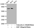 Western Blot
Positive WB detected in Hela whole cell lysate(treated with Calyculin A or EGF) 
All lanes Phospho-RAF1 antibody at 1.525μg/ml
Secondary
Goat polyclonal to rabbit IgG at 1/50000 dilution
Predicted band size: 73 KDa
Observed band size: 73 KDa