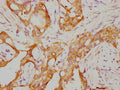 RARA Antibody – Figure 1 of 1