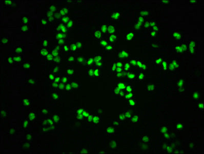 Immunofluorescence staining of K562 cells with CSB-RA019386A807phHU at 1:100,counter-stained with DAPI. The cells were fixed in 4% formaldehyde, permeabilized using 0.2% Triton X-100 and blocked in 10% normal Goat Serum. The cells were then incubated with the antibody overnight at 4℃. The secondary antibody was Alexa Fluor 488-congugated AffiniPure Goat Anti-Rabbit IgG (H+L) .