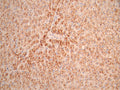 IHC image of CSB-RA019483MA1HU diluted at 1:50 and staining in paraffin-embedded human liver tissue performed on a Leica BondTM system. After dewaxing and hydration, antigen retrieval was mediated by high pressure in a citrate buffer (pH 6.0). Section was blocked with 10% normal goat serum 30min at RT. Then primary antibody (1% BSA) was incubated at 4°C overnight. The primary is detected by a Anti-Human lgG, Fcy Fragment Specific labeled by HRP and visualized using 0.05% DAB.