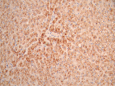 IHC image of CSB-RA019483MA1HU diluted at 1:50 and staining in paraffin-embedded human liver tissue performed on a Leica BondTM system. After dewaxing and hydration, antigen retrieval was mediated by high pressure in a citrate buffer (pH 6.0). Section was blocked with 10% normal goat serum 30min at RT. Then primary antibody (1% BSA) was incubated at 4°C overnight. The primary is detected by a Anti-Human lgG, Fcy Fragment Specific labeled by HRP and visualized using 0.05% DAB.
