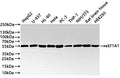 Western Blot
Positive WB detected in: HepG2 whole cell lysate(30µg) ,U-937 whole cell lysate(30µg) , HL-60 whole cell lysate(30µg) , Hela whole cell lysate(30µg) , PC-3 whole cell lysate(30µg) ,THP-1 whole cell lysate(30µg) ,NIH/3T3 whole cell lysate(30µg) ,HEK293 whole cell lysate(30µg) , Rat brain tissue lysate(30µg) 
All lanes: eEF1A1 antibody at 1:1000
Secondary
Goat polyclonal to rabbit IgG at 1/40000 dilution
Predicted band size: 50 kDa
Observed band size: 55 kDa
Exposure time：20s