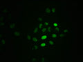 Immunofluorescence staining of Hela cells with CSB-RA020089A21phHU at 1:100,counter-stained with DAPI. The cells were fixed in 4% formaldehyde, permeabilized using 0.2% Triton X-100 and blocked in 10% normal Goat Serum. The cells were then incubated with the antibody overnight at 4℃. The secondary antibody was Alexa Fluor 488-congugated AffiniPure Goat Anti-Rabbit IgG (H+L) .