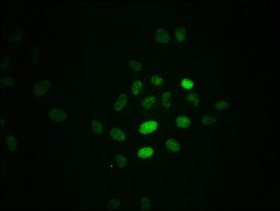 Immunofluorescence staining of Hela cells with CSB-RA020089A21phHU at 1:100,counter-stained with DAPI. The cells were fixed in 4% formaldehyde, permeabilized using 0.2% Triton X-100 and blocked in 10% normal Goat Serum. The cells were then incubated with the antibody overnight at 4℃. The secondary antibody was Alexa Fluor 488-congugated AffiniPure Goat Anti-Rabbit IgG (H+L) .