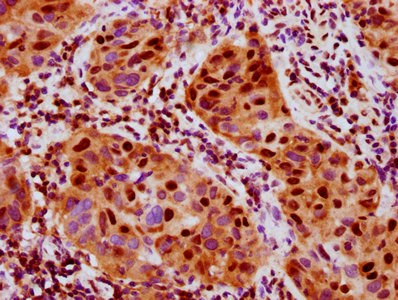 Phospho-RPS6KA5 (S376) Antibody – Figure 1 of 1