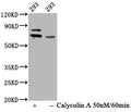 Phospho-RPS6KB1 (T421+S424) Antibody – Figure 1 of 3
