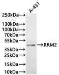 Western Blot
Positive WB detected in: A-431 whole cell lysate(30µg)
All lanes: RRM2 antibody at 1:1000
Secondary
Goat polyclonal to human IgG at 1/40000 dilution
Predicted band size: 45 kDa
Observed band size: 45 kDa
Exposure time: 5min