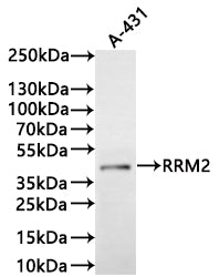 Western Blot
Positive WB detected in: A-431 whole cell lysate(30µg)
All lanes: RRM2 antibody at 1:1000
Secondary
Goat polyclonal to human IgG at 1/40000 dilution
Predicted band size: 45 kDa
Observed band size: 45 kDa
Exposure time: 5min