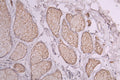 IHC image of CSB-RA020888MA1HU diluted at 1:300 and staining in paraffin-embedded human skin tissue performed on a Leica BondTM system. After dewaxing and hydration, antigen retrieval was mediated by high pressure in a citrate buffer (pH 6.0) . Section was blocked with 10% normal goat serum 30min at RT. Then primary antibody (1% BSA) was incubated at 4°C overnight. The primary is detected by a Goat anti-Human IgG labeled by HRP and visualized using 0.05% DAB.