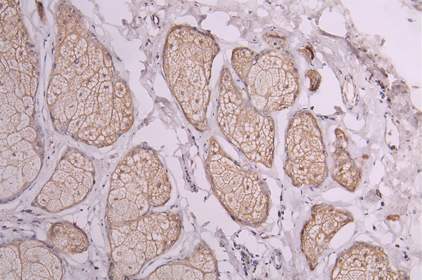 IHC image of CSB-RA020888MA1HU diluted at 1:300 and staining in paraffin-embedded human skin tissue performed on a Leica BondTM system. After dewaxing and hydration, antigen retrieval was mediated by high pressure in a citrate buffer (pH 6.0) . Section was blocked with 10% normal goat serum 30min at RT. Then primary antibody (1% BSA) was incubated at 4°C overnight. The primary is detected by a Goat anti-Human IgG labeled by HRP and visualized using 0.05% DAB.