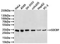 Western Blot
Positive WB detected in: Hela whole cell lysate(20µg) , A549 whole cell lysate(20µg) , SH-SY5Y whole cell lysate(20µg) , colo205 whole cell lysate(20µg) , HepG2 whole cell lysate(20µg) , PC-3 whole cell lysate(20µg) 
All lanes: SDCBP antibody at 1:1000
Secondary
Goat polyclonal to human IgG at 1/40000 dilution
Predicted band size: 32 kDa
Observed band size: 32 kDa
Exposure time: 2min