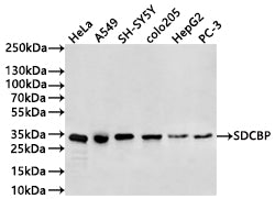 Western Blot
Positive WB detected in: Hela whole cell lysate(20µg) , A549 whole cell lysate(20µg) , SH-SY5Y whole cell lysate(20µg) , colo205 whole cell lysate(20µg) , HepG2 whole cell lysate(20µg) , PC-3 whole cell lysate(20µg) 
All lanes: SDCBP antibody at 1:1000
Secondary
Goat polyclonal to human IgG at 1/40000 dilution
Predicted band size: 32 kDa
Observed band size: 32 kDa
Exposure time: 2min