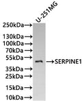 Western Blot
Positive WB detected in: U-251MG whole cell lysate(20µg) 
All lanes: SERPINE1 antibody at 1:1000
Secondary
Goat polyclonal to human IgG at 1/40000 dilution
Predicted band size: 45 kDa
Observed band size: 45 kDa
Exposure time：5min