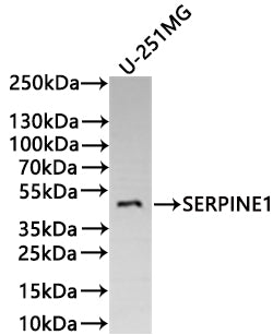 Western Blot
Positive WB detected in: U-251MG whole cell lysate(20µg) 
All lanes: SERPINE1 antibody at 1:1000
Secondary
Goat polyclonal to human IgG at 1/40000 dilution
Predicted band size: 45 kDa
Observed band size: 45 kDa
Exposure time：5min