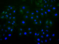 Immunofluorescence staining of Hela cell with CSB-RA021189MA1HU at 1:30 ,counter-stained with DAPI. The cells were fixed in 4% formaldehyde, permeabilized using 0.2% Triton X-100 and blocked in 10% normal Goat Serum. The cells were then incubated with the antibody overnight at 4°C. The secondary antibody was Alexa Fluor 488-congugated AffiniPure Goat Anti-Human IgG(H+L) .
