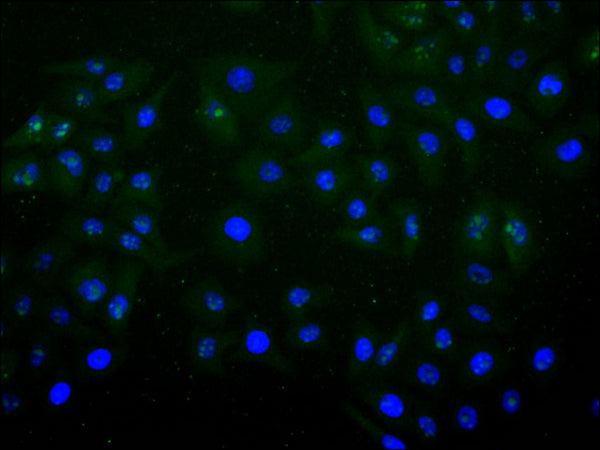 Immunofluorescence staining of Hela cell with CSB-RA021189MA1HU at 1:30 ,counter-stained with DAPI. The cells were fixed in 4% formaldehyde, permeabilized using 0.2% Triton X-100 and blocked in 10% normal Goat Serum. The cells were then incubated with the antibody overnight at 4°C. The secondary antibody was Alexa Fluor 488-congugated AffiniPure Goat Anti-Human IgG(H+L) .