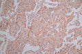 SLAMF7 Recombinant Monoclonal Antibody – Figure 1 of 2
