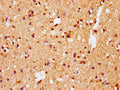 IHC image of CSB-RA021912A129phHU diluted at 1:100 and staining in paraffin-embedded human brain tissue performed on a Leica BondTM system. After dewaxing and hydration, antigen retrieval was mediated by high pressure in a citrate buffer (pH 6.0) . Section was blocked with 10% normal goat serum 30min at RT. Then primary antibody (1% BSA) was incubated at 4℃ overnight. The primary is detected by a biotinylated secondary antibody and visualized using an HRP conjugated SP system.