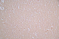 IHC image of CSB-RA021912MA1HU diluted at 1:100 and staining in paraffin-embedded human brain tissue performed on a Leica BondTM system. After dewaxing and hydration, antigen retrieval was mediated by high pressure in a citrate buffer (pH 6.0) . Section was blocked with 10% normal goat serum 30min at RT. Then primary antibody (1% BSA) was incubated at 4°C overnight. The primary is detected by a Goat anti-Mouse IgG labeled by HRP and visualized using 0.05% DAB.