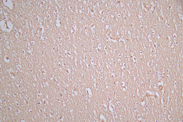 IHC image of CSB-RA021912MA1HU diluted at 1:100 and staining in paraffin-embedded human brain tissue performed on a Leica BondTM system. After dewaxing and hydration, antigen retrieval was mediated by high pressure in a citrate buffer (pH 6.0) . Section was blocked with 10% normal goat serum 30min at RT. Then primary antibody (1% BSA) was incubated at 4°C overnight. The primary is detected by a Goat anti-Mouse IgG labeled by HRP and visualized using 0.05% DAB.