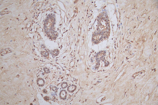 IHC image of CSB-RA022332MA1HU diluted at 1:50 and staining in paraffin-embedded human breast tissue performed on a Leica BondTM system. After dewaxing and hydration,  antigen retrieval was mediated by high pressure in a citrate buffer (pH 6.0) . Section was blocked with 10% normal goat serum 30min at RT. Then primary antibody (1% BSA) was incubated at 4°C overnight. The primary is detected by a Goat anti-mouse polymer IgG labeled by HRP and visualized using 0.05% DAB.
