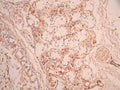 IHC image of CSB-RA022590MA1HU diluted at 1:50 and staining in paraffin-embedded human lung tissue performed on a Leica BondTM system. After dewaxing and hydration, antigen retrieval was mediated by high pressure in a citrate buffer (pH 6.0). Section was blocked with 10% normal goat serum 30min at RT. Then primary antibody (1% BSA) was incubated at 4°C overnight. The primary is detected by a Anti-Human lgG, Fcy Fragment Specific labeled by HRP and visualized using 0.05% DAB.