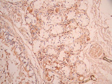 IHC image of CSB-RA022590MA1HU diluted at 1:50 and staining in paraffin-embedded human lung tissue performed on a Leica BondTM system. After dewaxing and hydration, antigen retrieval was mediated by high pressure in a citrate buffer (pH 6.0). Section was blocked with 10% normal goat serum 30min at RT. Then primary antibody (1% BSA) was incubated at 4°C overnight. The primary is detected by a Anti-Human lgG, Fcy Fragment Specific labeled by HRP and visualized using 0.05% DAB.
