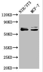 Western Blot
Positive WB detected in: NIH/3T3 whole cell lysate, MCF-7 whole cell lysate
All lanes: SRC antibody at 1.2μg/ml
Secondary
Goat polyclonal to rabbit IgG at 1/50000 dilution
Predicted band size: 60, 61 KDa
Observed band size: 60, 61 KDa