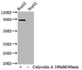 Western Blot
Positive WB detected in HepG2 whole cell lysate(treated with Calyculin A or not) 
All lanes Phospho-STAT1 antibody at 1.065μg/ml
Secondary
Goat polyclonal to rabbit IgG at 1/50000 dilution
Predicted band size: 87 KDa
Observed band size: 87 KDa