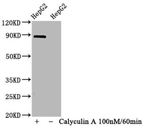 Western Blot
Positive WB detected in HepG2 whole cell lysate(treated with Calyculin A or not) 
All lanes Phospho-STAT1 antibody at 1.065μg/ml
Secondary
Goat polyclonal to rabbit IgG at 1/50000 dilution
Predicted band size: 87 KDa
Observed band size: 87 KDa