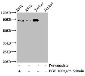 Western Blot
Positive WB detected in A549 whole cell lysate,Jurkat whole cell lysate(treated with EGF or Pervanadate) 
All lanes Phospho-STAT3 antibody at 0.925μg/ml
Secondary
Goat polyclonal to rabbit IgG at 1/50000 dilution
Predicted band size: 88 KDa
Observed band size: 88 KDa