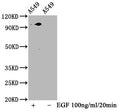 Western Blot
Positive WB detected in A549 whole cell lysate(treated with EGF or not) 
All lanes Phospho-STAT3 antibody at 1.88μg/ml
Secondary
Goat polyclonal to rabbit IgG at 1/50000 dilution
Predicted band size: 98 KDa
Observed band size: 98 KDa