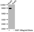 Western Blot
Positive WB detected in HepG2 whole cell lysate(treated with EGF or not) 
All lanes Phospho-STAT5A antibody at 1.025μg/ml
Secondary
Goat polyclonal to rabbit IgG at 1/50000 dilution
Predicted band size: 90 KDa
Observed band size: 90 KDa