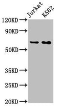 Western Blot
Positive WB detected in: Jurkat whole cell lysate, K562 whole cell lysate
All lanes: STIP1 antibody at 0.9μg/ml
Secondary
Goat polyclonal to rabbit IgG at 1/50000 dilution
Predicted band size: 63, 69, 60 KDa
Observed band size: 63 KDa