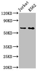 Western Blot
Positive WB detected in: Jurkat whole cell lysate, K562 whole cell lysate
All lanes: STIP1 antibody at 0.9μg/ml
Secondary
Goat polyclonal to rabbit IgG at 1/50000 dilution
Predicted band size: 63, 69, 60 KDa
Observed band size: 63 KDa