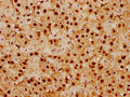 IHC image of CSB-RA022948A0HU diluted at 1:92.5 and staining in paraffin-embedded human adrenal gland tissue performed on a Leica BondTM system. After dewaxing and hydration, antigen retrieval was mediated by high pressure in a citrate buffer (pH 6.0) . Section was blocked with 10% normal goat serum 30min at RT. Then primary antibody (1% BSA) was incubated at 4℃ overnight. The primary is detected by a biotinylated secondary antibody and visualized using an HRP conjugated SP system.
